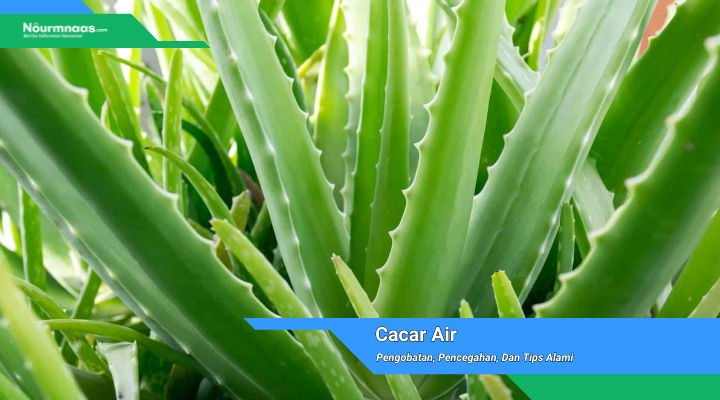 Pengobatan Pencegahan Dan Tips Alami Cacar Air 1